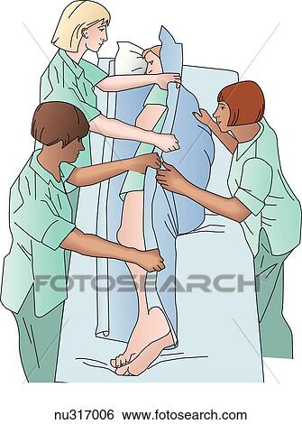 Illustration showing three nurses turning patient (logrolling) with a spinal cord injury. One nurse stands on the side, holding the draw-sheet taunt. The patient is moved toward the other nurses on a predetermined signal. View Large Illustration Stock Illustration - Illustration showing three nurses turning patient (logrolling) with a spinal cord injury. One nurse stands on the side, holding the draw-sheet taunt. The patient is moved toward the other nurses on a predetermined signal.. Fotosearch