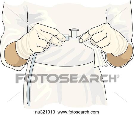 Image shows hands of healthcare professional connecting catheter to suction tube. View Large Illustration Drawing - Image shows hands of healthcare professional connecting catheter to suction tube.. Fotosearch