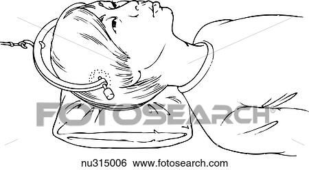 Lateral view of male head resting on pillow with Gardner-Wills traction tongs in place. View Large Illustration Stock Illustration - Lateral view of male head resting on pillow with Gardner-Wills traction tongs in place.. Fotosearch