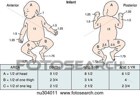 Outline of infant body with areas and percentages indicated to calculate total burn surface area. Left: anterior view. Right: posterior view. View Large Illustration Clip Art - Outline of infant body with areas and percentages indicated to calculate total burn surface area. Left: anterior view. Right: posterior view.. Fotosearch