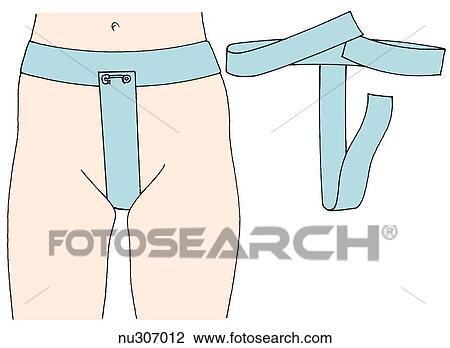 Drawing - Simple drawing of woman from waist to thigh (left) showing proper positioning of T-binder. T-binder alone shown on right.. Fotosearch