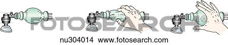 Stock Illustration - Technique for using self inflating Ambu bag with compressed gas source for neonatal resuscitation.. Fotosearch