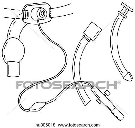 The parts of a cuffeds tracheostomy set- outertube and cuff (left), cannula (center), obturator (right). View Large Illustration Stock Illustration - The parts of a cuffeds tracheostomy set- outertube and cuff (left), cannula (center), obturator (right).. Fotosearch