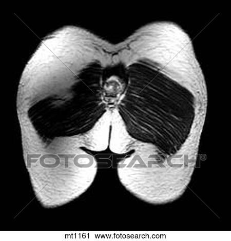 Clip Art - Abdomen - Coronal. Fotosearch
