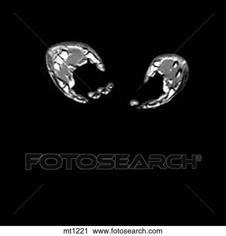 Abdomen - Coronal View Large Illustration Clip Art - Abdomen - Coronal. Fotosearch