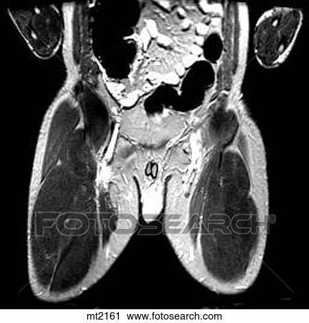 Abdomen - Coronal View Large Illustration Clip Art - Abdomen - Coronal. Fotosearch