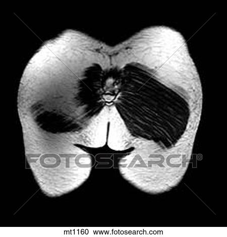 Abdomen - Coronal View Large Illustration Clipart - Abdomen - Coronal. Fotosearch