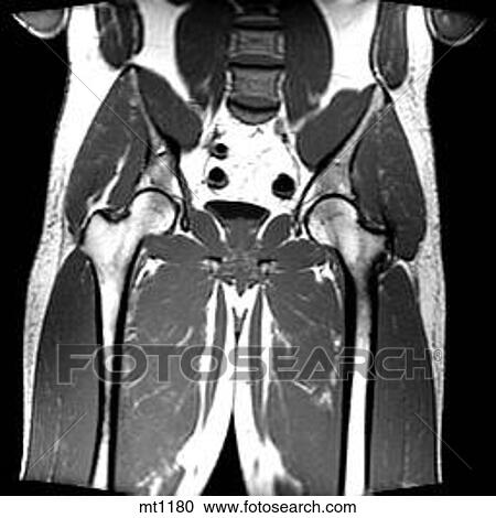 Abdomen - Coronal View Large Illustration Clipart - Abdomen - Coronal. Fotosearch