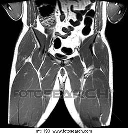 Clipart - Abdomen - Coronal. Fotosearch