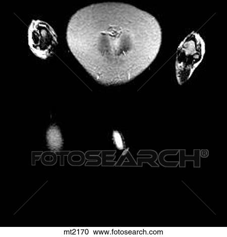 Abdomen - Coronal View Large Illustration Clipart - Abdomen - Coronal. Fotosearch