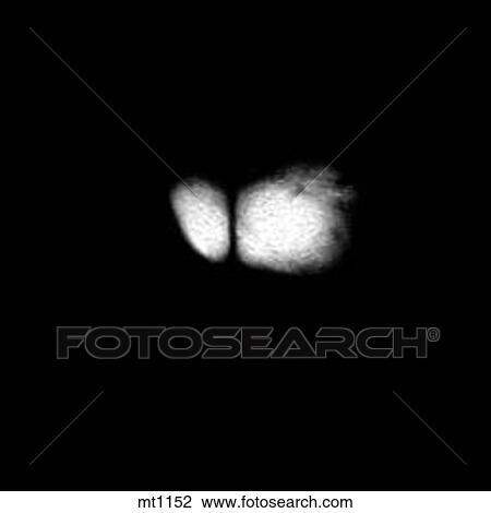 Drawing - Abdomen - Coronal. Fotosearch
