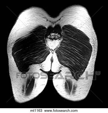 Abdomen - Coronal View Large Illustration Drawing - Abdomen - Coronal. Fotosearch