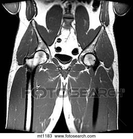 Abdomen - Coronal View Large Illustration Drawing - Abdomen - Coronal. Fotosearch