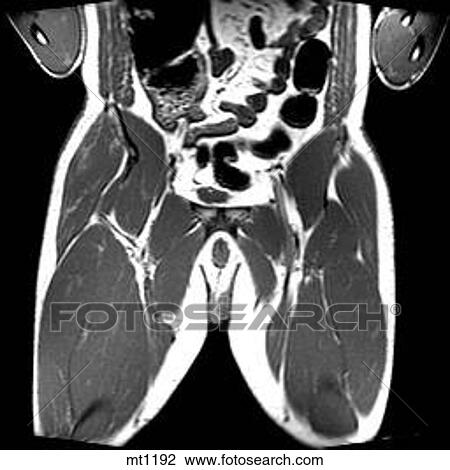Drawing - Abdomen - Coronal. Fotosearch