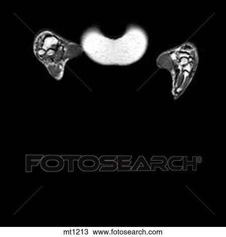 Abdomen - Coronal View Large Illustration Drawing - Abdomen - Coronal. Fotosearch