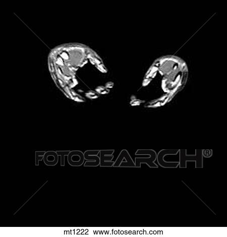 Drawing - Abdomen - Coronal. Fotosearch