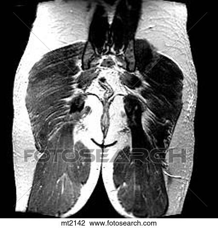 Drawing - Abdomen - Coronal. Fotosearch