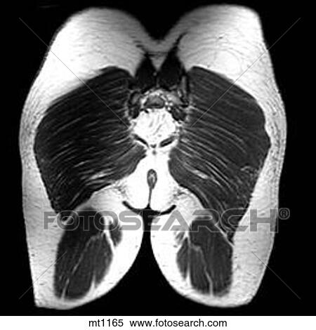 Abdomen - Coronal View Large Illustration Stock Illustration - Abdomen - Coronal. Fotosearch