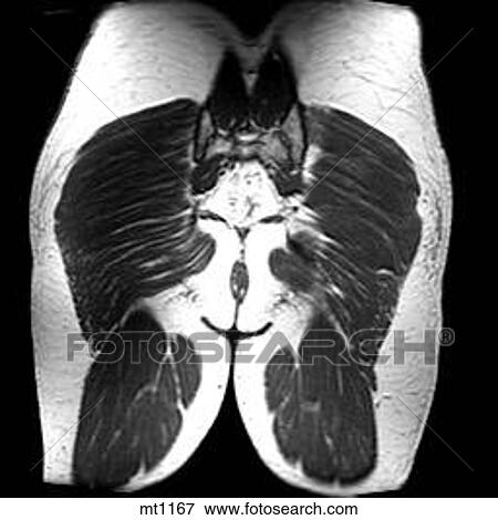 Abdomen - Coronal View Large Illustration Stock Illustration - Abdomen - Coronal. Fotosearch
