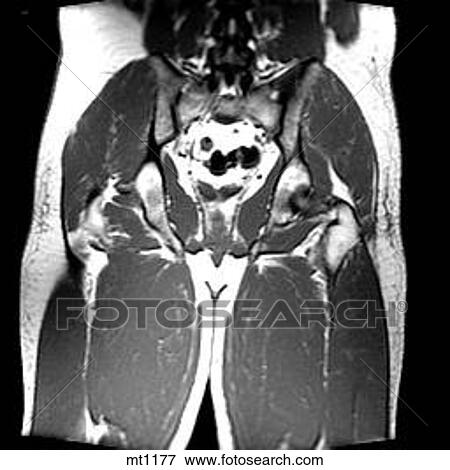 Abdomen - Coronal View Large Illustration Stock Illustration - Abdomen - Coronal. Fotosearch