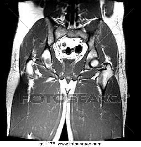 Stock Illustration - Abdomen - Coronal. Fotosearch