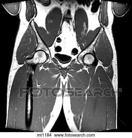 Abdomen - Coronal View Large Illustration Stock Illustration - Abdomen - Coronal. Fotosearch
