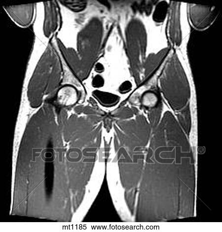 Abdomen - Coronal View Large Illustration Stock Illustration - Abdomen - Coronal. Fotosearch