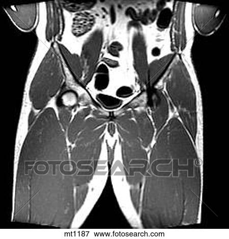 Abdomen - Coronal View Large Illustration Stock Illustration - Abdomen - Coronal. Fotosearch