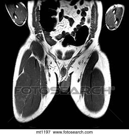 Abdomen - Coronal View Large Illustration Stock Illustration - Abdomen - Coronal. Fotosearch