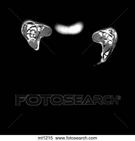 Abdomen - Coronal View Large Illustration Stock Illustration - Abdomen - Coronal. Fotosearch
