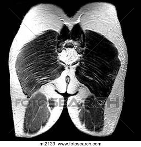 Abdomen - Coronal View Large Illustration Stock Illustration - Abdomen - Coronal. Fotosearch