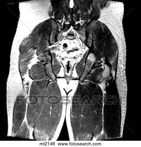 Stock Illustration - Abdomen - Coronal. Fotosearch