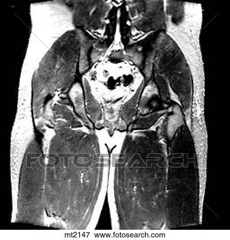 Abdomen - Coronal View Large Illustration Stock Illustration - Abdomen - Coronal. Fotosearch