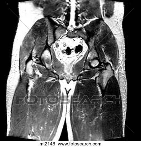 Stock Illustration - Abdomen - Coronal. Fotosearch
