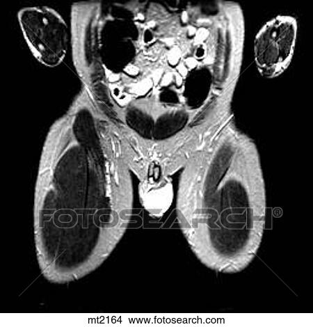 Abdomen - Coronal View Large Illustration Stock Illustration - Abdomen - Coronal. Fotosearch
