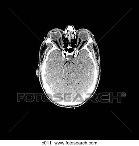 Clip Art - Head and Neck. Fotosearch