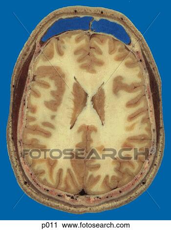 Clip Art - Head and Neck. Fotosearch