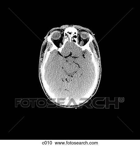 Clipart - Head and Neck. Fotosearch