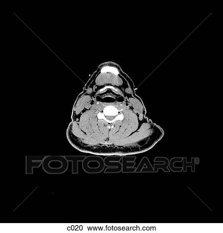 Head and Neck View Large Illustration Clipart - Head and Neck. Fotosearch