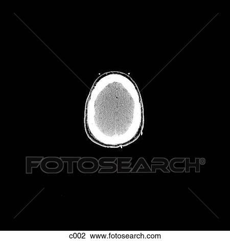Drawing - Head and Neck. Fotosearch