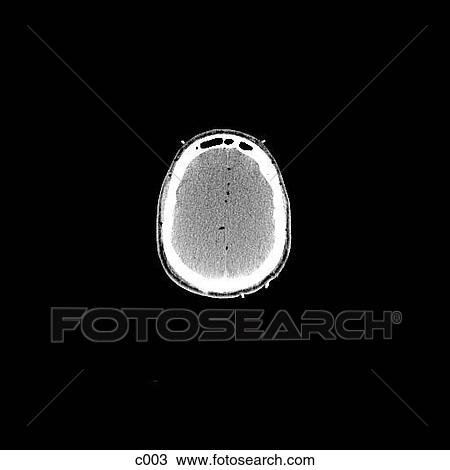 Drawing - Head and Neck. Fotosearch