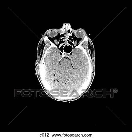 Drawing - Head and Neck. Fotosearch