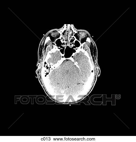 Drawing - Head and Neck. Fotosearch