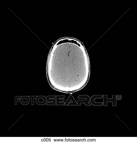 Stock Illustration - Head and Neck. Fotosearch