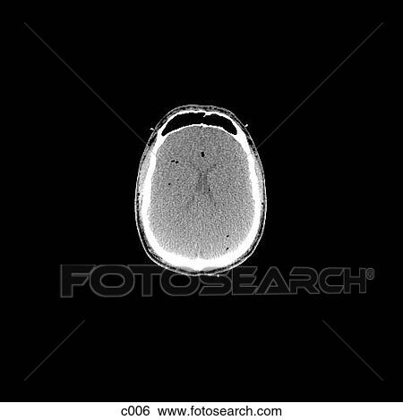 Head and Neck View Large Illustration Stock Illustration - Head and Neck. Fotosearch