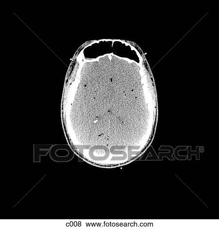 Stock Illustration - Head and Neck. Fotosearch