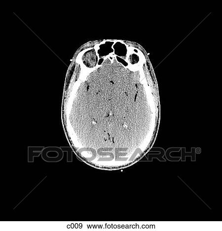 Head and Neck View Large Illustration Stock Illustration - Head and Neck. Fotosearch