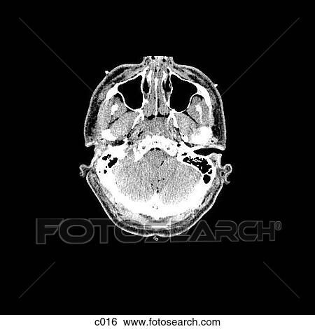 Head and Neck View Large Illustration Stock Illustration - Head and Neck. Fotosearch