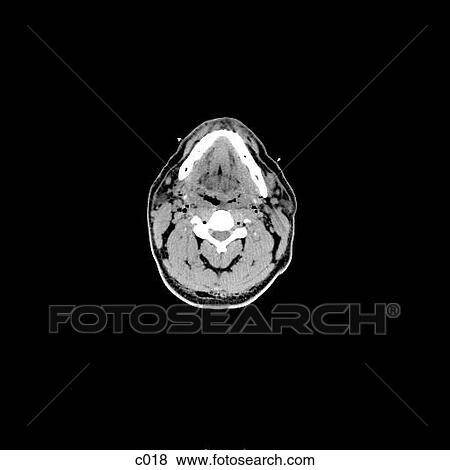 Head and Neck View Large Illustration Stock Illustration - Head and Neck. Fotosearch