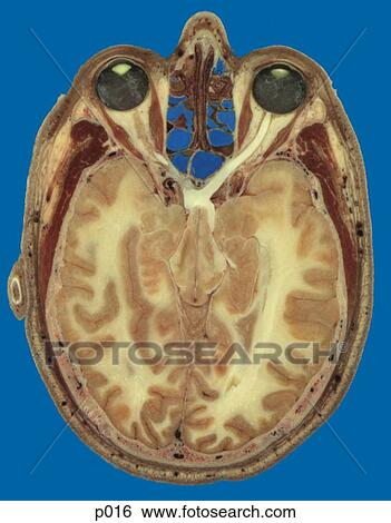 Head and Neck View Large Illustration Stock Illustration - Head and Neck. Fotosearch